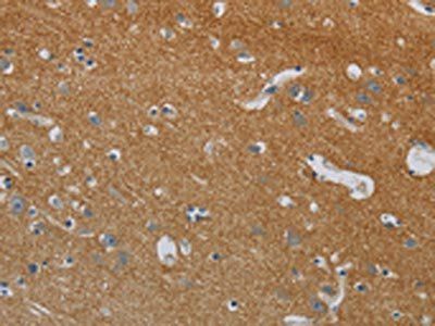 DPYSL3 Antibody