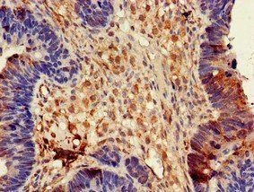 DPYSL4 Antibody