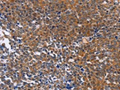 DPYSL4 Antibody