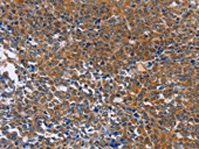 DPYSL4 antibody