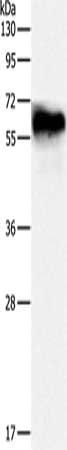DPYSL4 Antibody