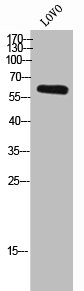 DPYSL4 antibody