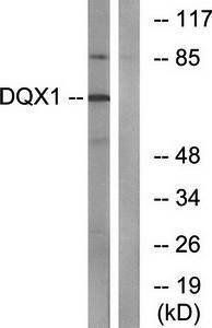 DQX1 antibody