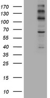 DR5 (TNFRSF10B) antibody