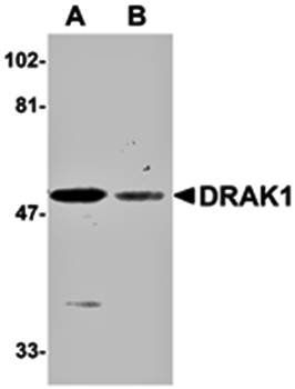 DRAK1 Antibody
