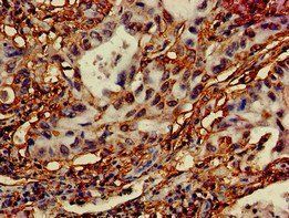 DRAM1 Antibody