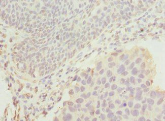DRAM2 Antibody