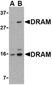 DRAM Antibody