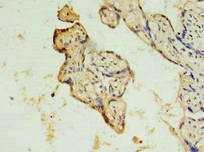 DRC7 Antibody