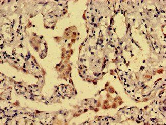DRD1 Antibody