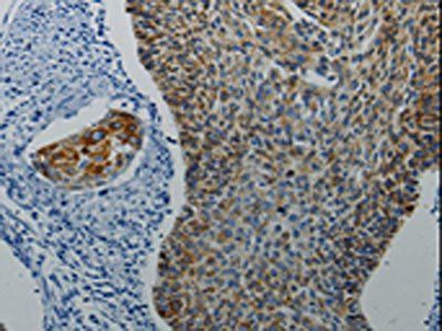 DRD4 Antibody
