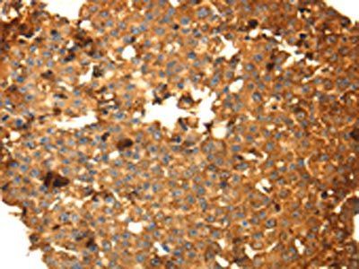 DRD5 Antibody