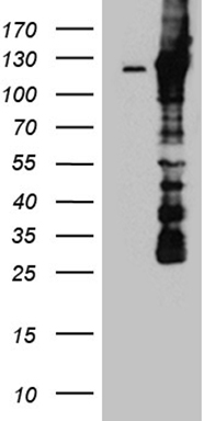 Drebrin (DBN1) antibody