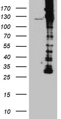 Drebrin (DBN1) antibody