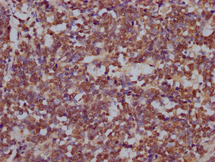 DROSHA Antibody