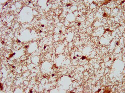 DSCAM Antibody