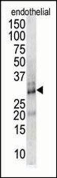 DSCR1 antibody