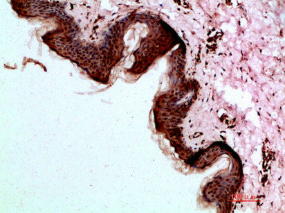 DSG1 antibody