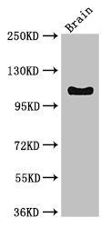DSG3 antibody