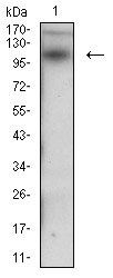 DSG3 Antibody