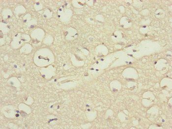DSN1 Antibody