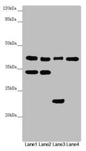 DSN1 Antibody
