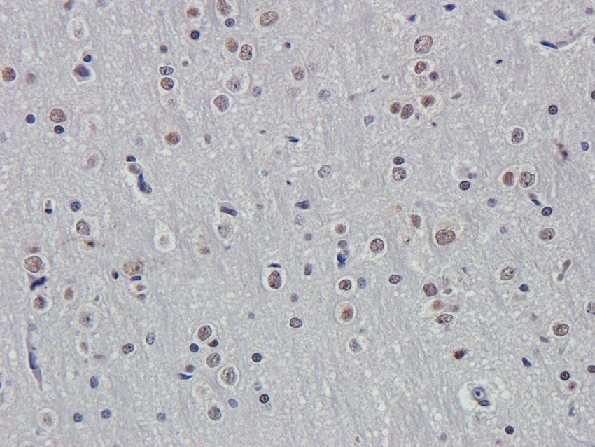 DSPP Rabbit Polyclonal Antibody