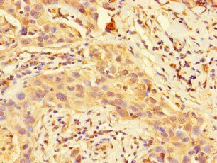 DSTN Antibody