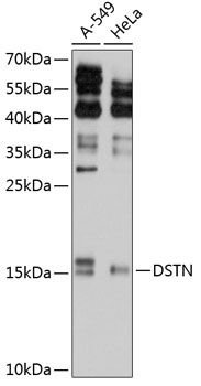 DSTN antibody