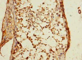 DSTYK Antibody