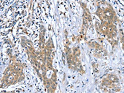 DSTYK Antibody