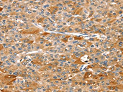 DSTYK Antibody