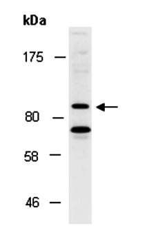DTL (N2) Antibody, Rabbit Polyclonal