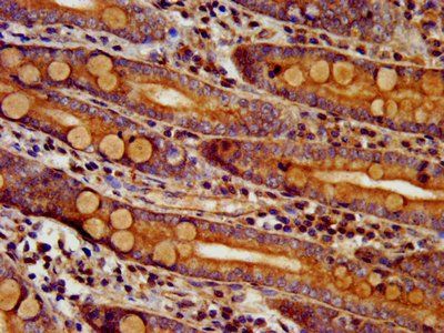 DTNBP1 Antibody