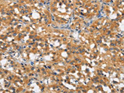 DTNBP1 Antibody