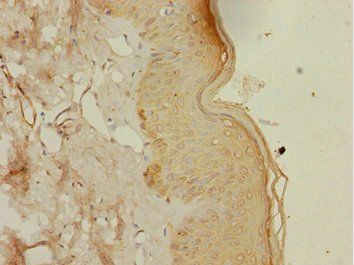 DTX2 Antibody