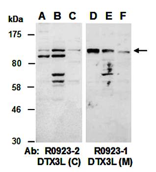 DTX3L (M) Antibody, Rabbit Polyclonal