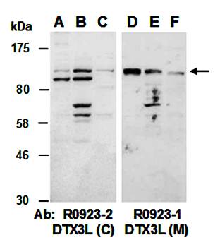 DTX3L antibody