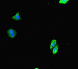 DTX4 antibody