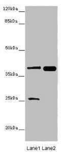 Dual specificity mitogen-activated protein kinase kinase 3 antibody