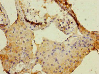 DUOX1 Antibody