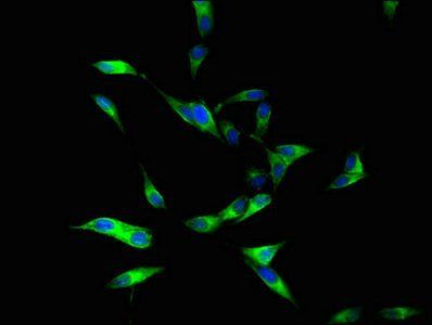 DUOXA1 Antibody