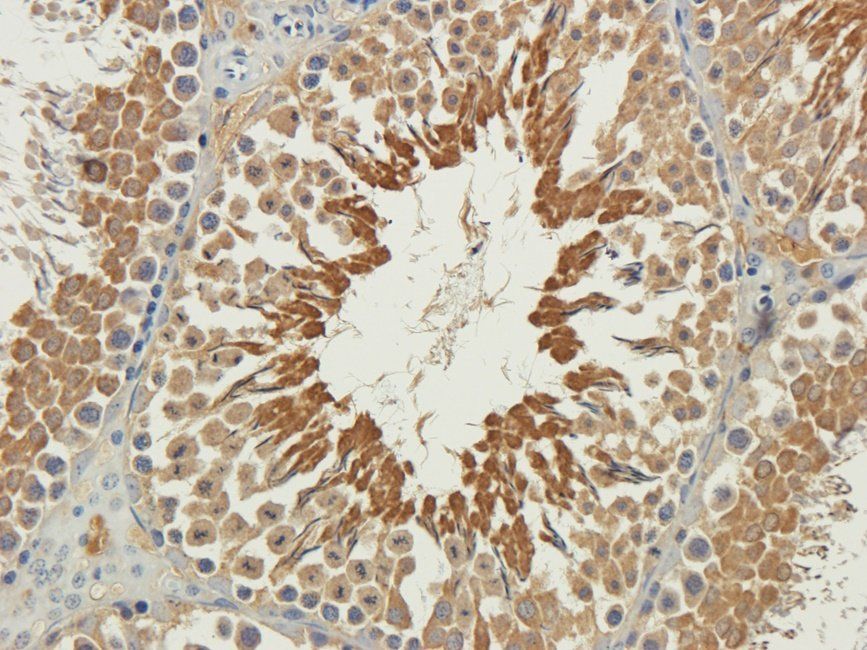 DUS16 Rabbit Polyclonal Antibody