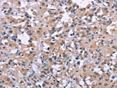 DUSP1 Antibody