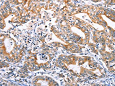 DUSP10 Antibody