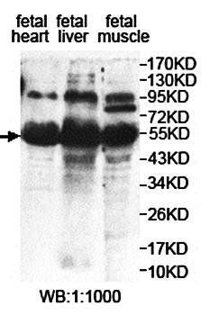 DUSP10 Rabbit Polyclonal Antibody