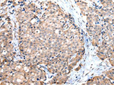 DUSP11 Antibody