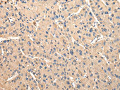 DUSP11 Antibody