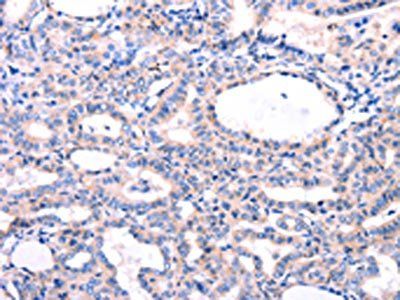 DUSP12 Antibody