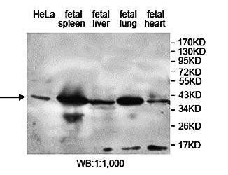 DUSP12 Rabbit Polyclonal Antibody